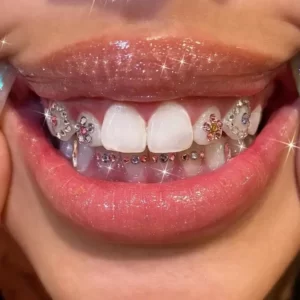 Jewelry teeth gem crystals diamond stone decoration